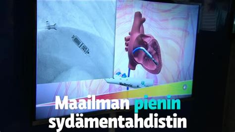  Quinquefasciatus! Kysymys: Mikä on tämä pieni vedenalaisen maailman ihme ja kuinka se elää?